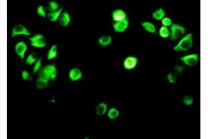 Detection of VIM in MCF7 cells using Polyclonal Antibody to Vimentin (VIM) (Vimentin antibody  (AA 2-466))