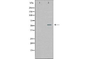 Western blot analysis of extracts from 293 cells, using WASF2 antibody. (WASF2 antibody  (Internal Region))