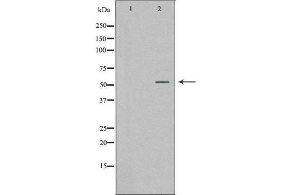 WASF2 antibody  (Internal Region)