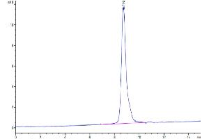 LTK Protein (AA 17-424) (His tag)