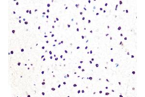 Immunohistochemistry of paraffin-embedded rat brain using DDB1 Rabbit mAb (ABIN7266673) at dilution of 1:100 (40x lens). (DDB1 antibody)