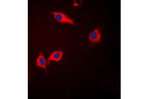 Immunofluorescent analysis of CK1 alpha staining in Jurkat cells. (CSNK1A1 antibody  (Center))
