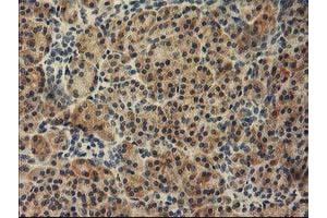 Immunohistochemical staining of paraffin-embedded Human pancreas tissue using anti-TBC1D21 mouse monoclonal antibody. (TBC1D21 antibody)