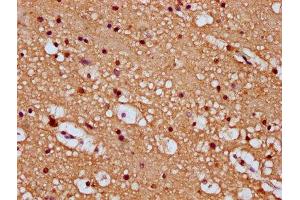 IHC image of ABIN7168823 diluted at 1:100 and staining in paraffin-embedded human brain tissue performed on a Leica BondTM system. (SEMA6B antibody  (AA 756-888))