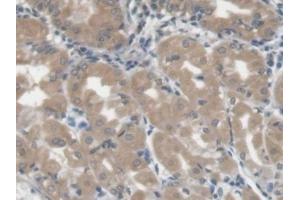 Detection of LGALS3BP in Human Stomach Tissue using Monoclonal Antibody to Lectin Galactoside Binding, Soluble 3 Binding Protein (LGALS3BP) (LGALS3BP antibody  (AA 24-221))