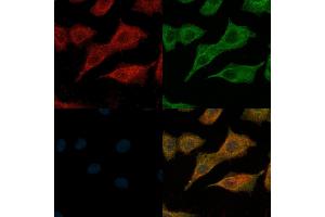 ABIN6260340 and ABIN6269120 staining  cells(H2O2 treatment) by IF/ICC. (c-MET antibody  (Internal Region))