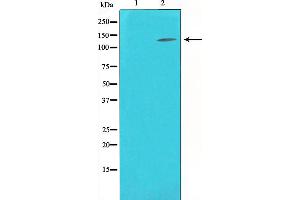 Western blot analysis on K562 cell lysate using eNOS Antibody,The lane on the left is treated with the antigen-specific peptide. (ENOS antibody  (C-Term))