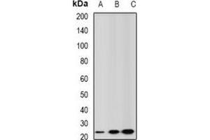 Western blot analysis of GSTA2 expression in mouse liver (A), mouse testis (B), rat kidney (C) whole cell lysates.