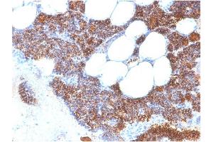 Formalin-fixed, paraffin-embedded human Parathyroid Gland stained with PTH-Monospecific Recombinant Rabbit Monoclonal Antibody (PTH/2295R). (Recombinant PTH antibody  (AA 32-115))