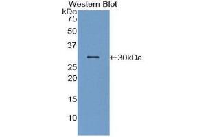 Western Blotting (WB) image for anti-Macrophage Stimulating 1 (Hepatocyte Growth Factor-Like) (MST1) (AA 469-704) antibody (ABIN1859890) (MST1 antibody  (AA 469-704))