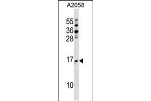 Western blot analysis in A2058 cell line lysates (35ug/lane). (NAT5 antibody  (C-Term))