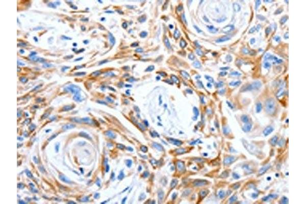 LRIG3 antibody