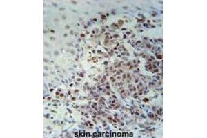 Immunohistochemistry (IHC) image for anti-X-Ray Repair Complementing Defective Repair in Chinese Hamster Cells 1 (XRCC1) antibody (ABIN3002379)