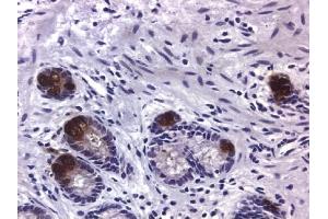 Immunohistochemistry (IHC) image for anti-Matrix Metallopeptidase 9 (Gelatinase B, 92kDa Gelatinase, 92kDa Type IV Collagenase) (MMP9) antibody (ABIN371659)