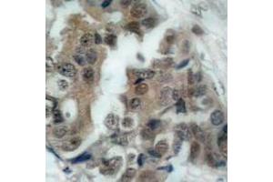 Image no. 2 for anti-BCL2-Associated Agonist of Cell Death (BAD) (pSer136), (pSer99) antibody (ABIN317969) (BAD antibody  (pSer99, pSer136))
