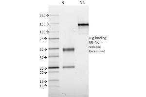 SDS-PAGE Analysis Purified Thyroid Peroxidase Mouse Monoclonal Antibody (TPO/1921). (TPO (AA 685-804) antibody)