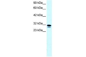 WB Suggested Anti-SSBP2 Antibody Titration: 0.