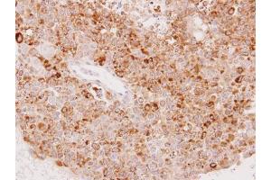 IHC-P Image Immunohistochemical analysis of paraffin-embedded OV90 xenograft, using UGT1A6, antibody at 1:100 dilution. (UGT1A6 antibody  (Center))