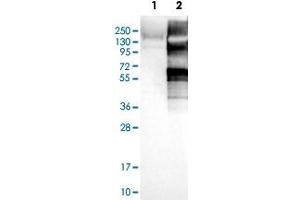 Western Blot analysis of Lane 1: negative control (vector only transfected HEK293T cell lysate) and Lane 2: over-expression lysate (co-expressed with a C-terminal myc-DDK tag in mammalian HEK293T cells) with USP20 polyclonal antibody . (USP20 antibody)