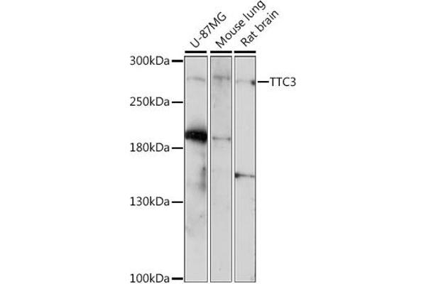 TTC3 Antikörper  (AA 1400-1700)