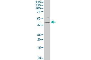 HOXA13 polyclonal antibody (A01), Lot # 051026JC01 Western Blot analysis of HOXA13 expression in HL-60 . (HOXA13 antibody  (AA 208-306))