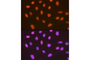 Immunofluorescence analysis of U-2 OS cells using SUMO4 Rabbit mAb (ABIN7270372) at dilution of 1:100 (40x lens). (SUMO4 antibody)