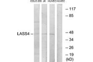 Western blot analysis of extracts from HuvEc/COLO/Jurkat cells, using LASS4 Antibody. (LASS4 antibody  (AA 41-90))
