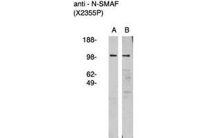 Image no. 1 for anti-Neutral Sphingomyelinase (N-SMase) Activation Associated Factor (NSMAF) antibody (ABIN793717) (NSMAF antibody)