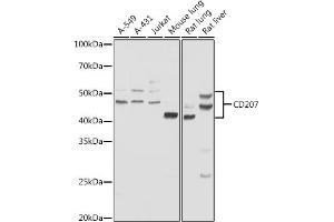 Western blot analysis of extracts of various cell lines, using CD207 antibody (ABIN6131544, ABIN6138141, ABIN6138142 and ABIN6222222) at 1:1000 dilution. (CD207 antibody  (AA 69-328))
