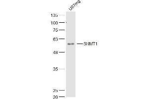 U87MG lysates probed with SHMT1 Polyclonal Antibody, Unconjugated  at 1:300 dilution and 4˚C overnight incubation. (SHMT1 antibody  (AA 301-400))