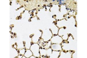 Immunohistochemistry of paraffin-embedded Mouse lung using IFI16 Polyclonal Antibody at dilution of 1:100 (40x lens). (IFI16 antibody)