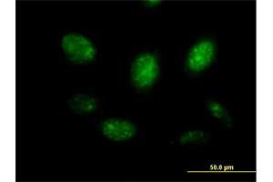 Immunofluorescence of purified MaxPab antibody to MYB on HeLa cell. (MYB antibody  (AA 1-640))