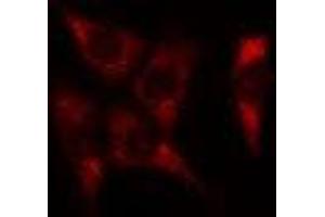 ABIN6278584 staining Hela cells by IF/ICC. (JTB antibody  (Internal Region))