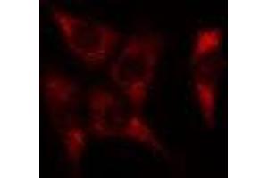 ABIN6278584 staining Hela cells by IF/ICC.