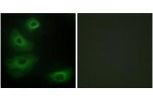 Immunofluorescence analysis of HeLa cells, using 5-HT-1B Antibody.