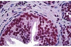 Human Prostate: Formalin-Fixed, Paraffin-Embedded (FFPE) (LHX4 antibody  (AA 291-390))