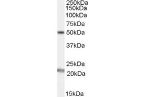 ABIN334340 (1µg/ml) staining of Human Brain (Substantia nigra) lysate (35µg protein in RIPA buffer). (Acylglycerol Kinase antibody  (C-Term))