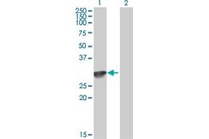 Western Blot analysis of C1QA expression in transfected 293T cell line by C1QA MaxPab polyclonal antibody.