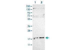 Western Blot (Cell lysate) analysis of (1) Human RT-4 cell and (2) Human U-251MG sp cell.