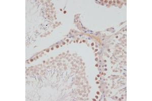 Immunohistochemistry of paraffin-embedded rat testis using Cyclin G1 antibody (ABIN6127734, ABIN6138095, ABIN6138096 and ABIN6220906) at dilution of 1:100 (40x lens).