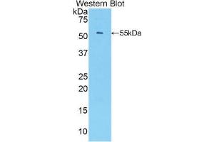 Western blot analysis of the recombinant protein. (CXCL1 antibody  (AA 25-96))