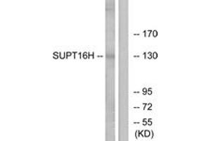Western blot analysis of extracts from HepG2/Jurkat cells, using SUPT16H Antibody. (SUPT16H antibody  (AA 941-990))