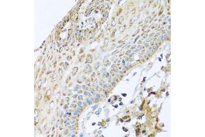 Immunohistochemistry of paraffin-embedded human esophagus using NDUFA2 antibody (ABIN5974497) at dilution of 1/100 (40x lens). (NDUFA2 antibody)