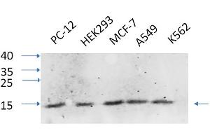 Western Blot analysis of PC-12 (1), HEK293 (2), MCF-7 (3), A549 (4), K562 (5), diluted at 1:1000. (IL-8 antibody  (C-Term))