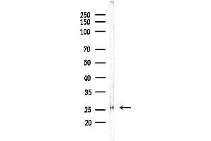 anti-GRB2-Related Adaptor Protein (GRAP) antibody