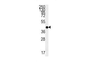 MC2R Antibody (C-term) (ABIN651731 and ABIN2840379) western blot analysis in WiDr cell line lysates (15 μg/lane). (MC2R antibody  (AA 261-288))