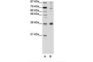Image no. 1 for anti-Forkhead Box Q1 (FOXQ1) (N-Term) antibody (ABIN202434)