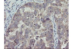 Image no. 1 for anti-rho GTPase Activating Protein 2 (ARHGAP2) antibody (ABIN1499627) (CHN1 antibody)
