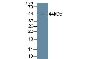 Detection of Recombinant C4c, Human using Monoclonal Antibody to Complement Component 4c (C4c) (Complement C4c antibody  (AA 19-333))