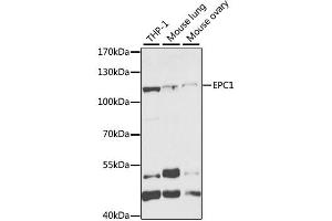 Western blot analysis of extracts of various cell lines, using EPC1 antibody (ABIN2562436) at 1:1000 dilution. (EPC1 antibody)
